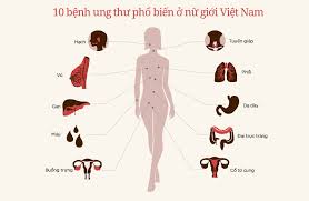 Phát hiện sớm những dấu hiệu ung thư ở nữ giới